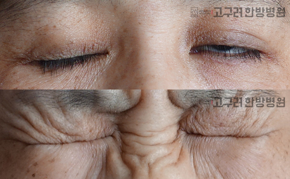 전후사진1