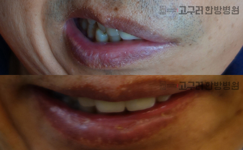 전후사진8
