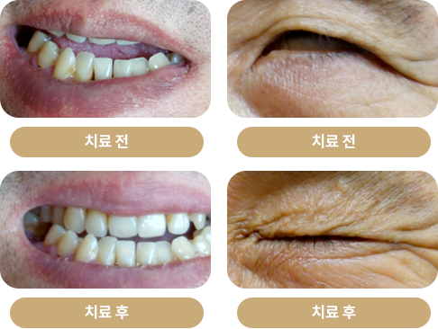 치료회복단계 사진1